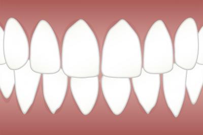 implant dentaire villejuif